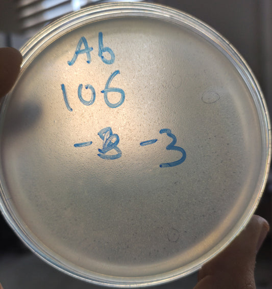 Acinetobacter baumannii bacteriophage 120106A