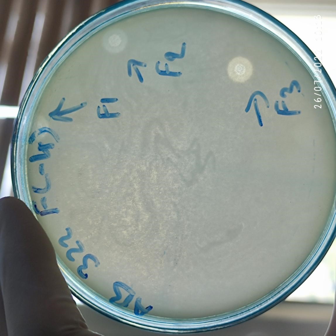 Acinetobacter baumannii bacteriophage 120322F
