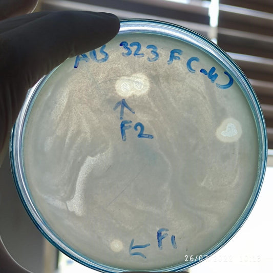 Acinetobacter baumannii bacteriophage 120323F