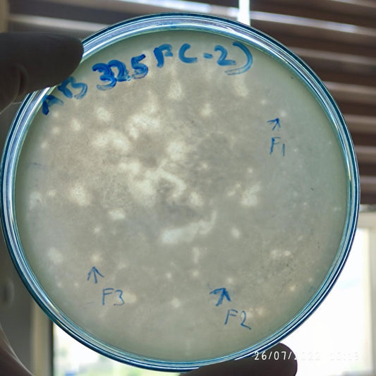 Acinetobacter baumannii bacteriophage 120325F