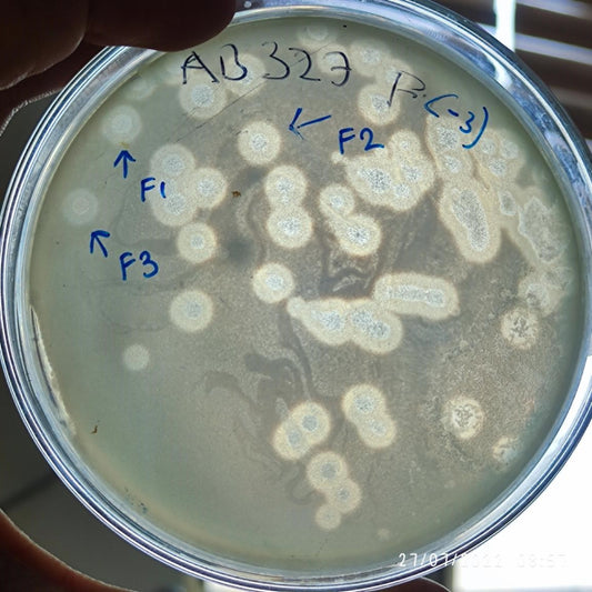 Acinetobacter baumannii bacteriophage 120327F