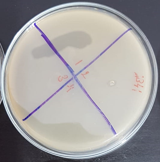 Acinetobacter baumannii bacteriophage 120041A
